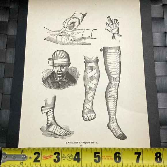 Vintage Medical Diagram | Bandages | Circa 1903 - Picture 5 of 6